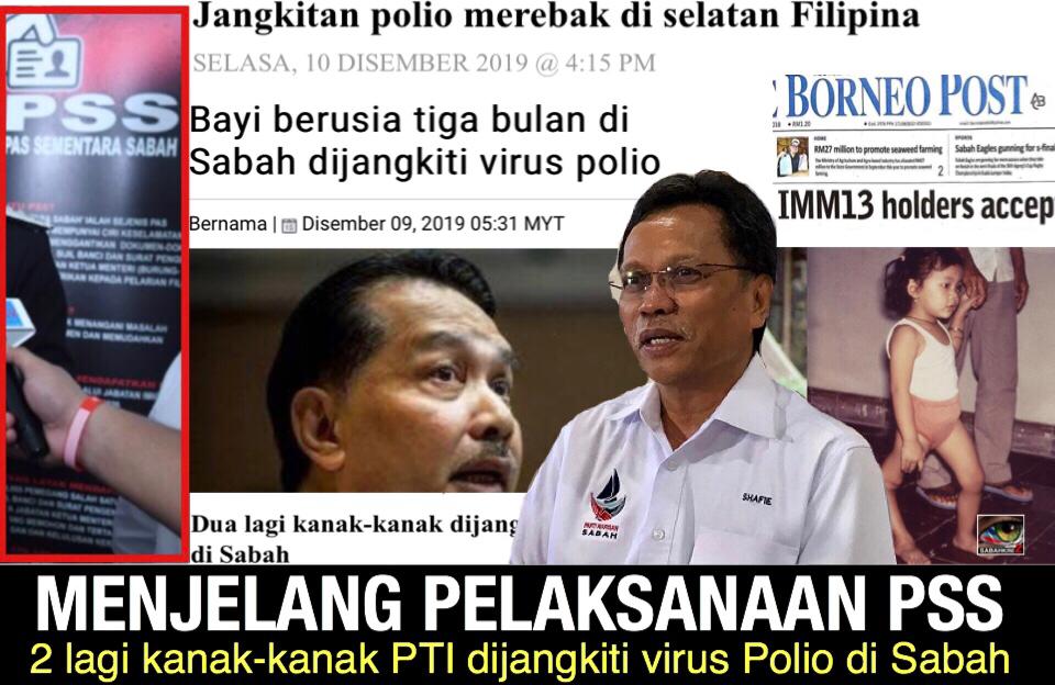 Menjelang pelaksanaan PSS, 2 lagi kanak-kanak PTI dijangkiti virus polio di Sabah